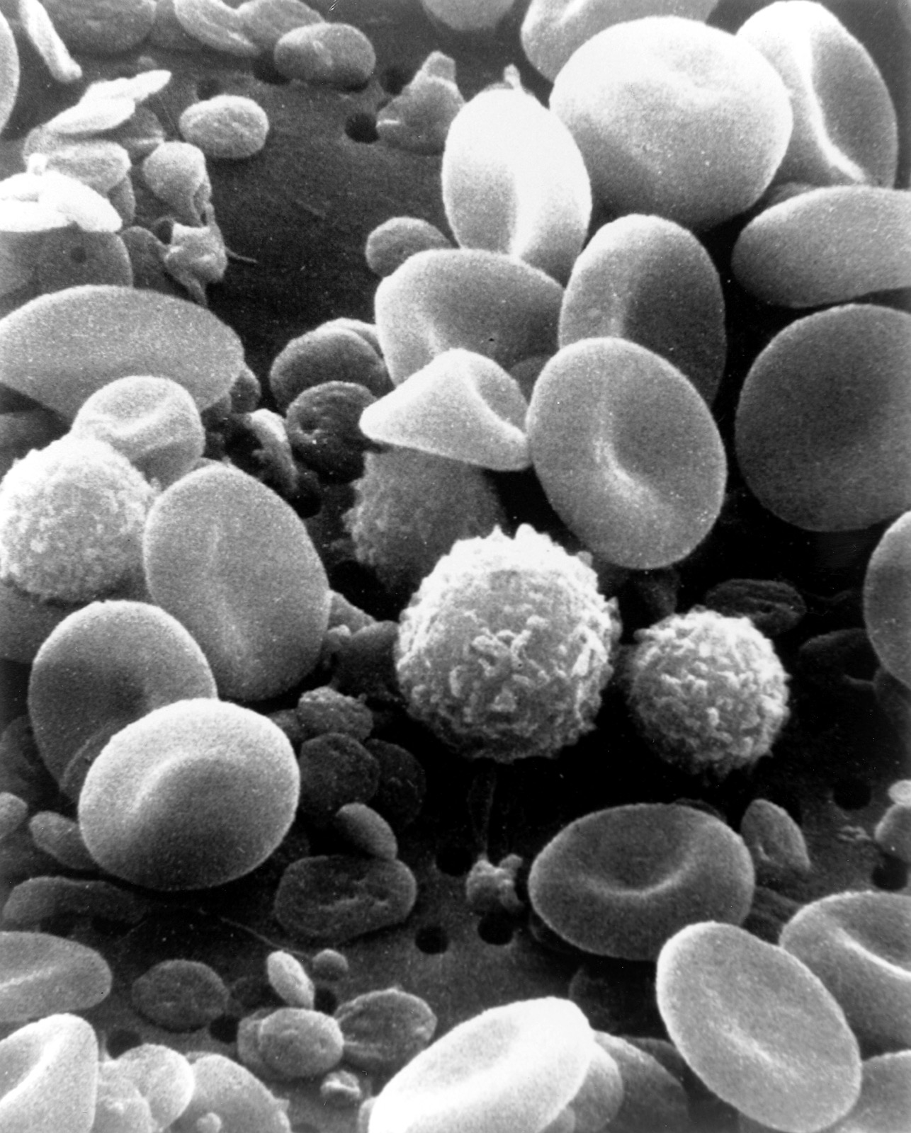 Scanning electron micrograph of normal circulating human blood cells