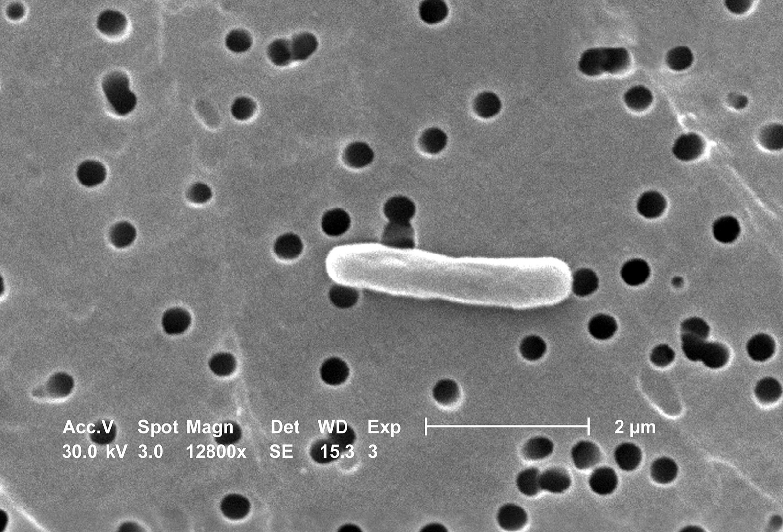 Colorized scanning electron micrograph of Escherichia coli bacteria